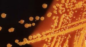 Colonies of E. coli bacteria grown on a Hektoen enteric (HE) agar plate are seen in a microscopic image